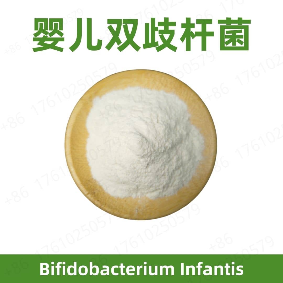 Bifidobacterium infantis
